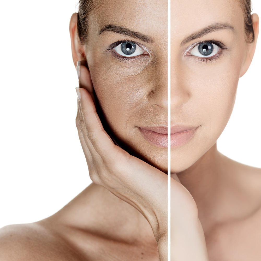 Whitening