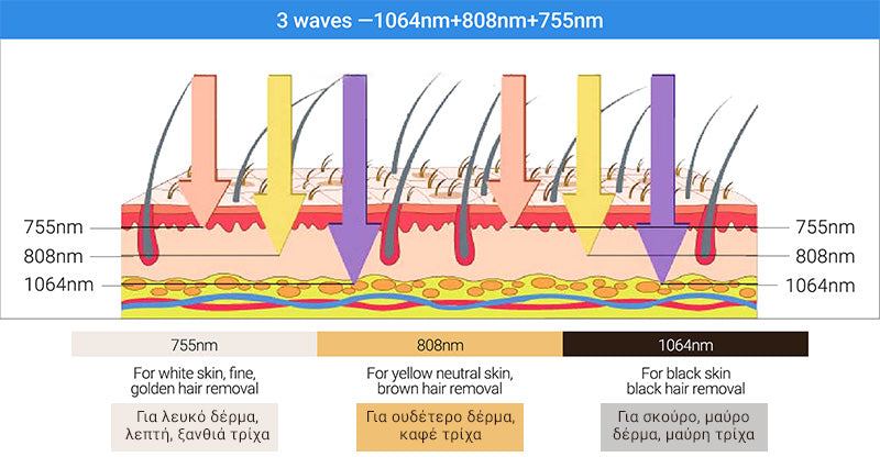 Laser Hair Removal Diode Technology – 755 nm - 808 nm – 1064 nm
